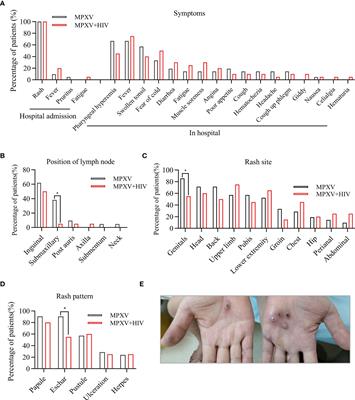 Clinical characteristics, viral dynamics, and antibody response of monkeypox virus infections among men with and without HIV infection in Guangzhou, China